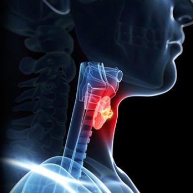 Microcirurgia de Laringe