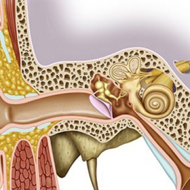 Timpanoplastia