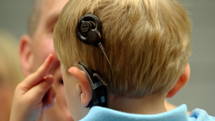Qual a diferença entre o Implante Coclear e os aparelhos auditivos convencionais?