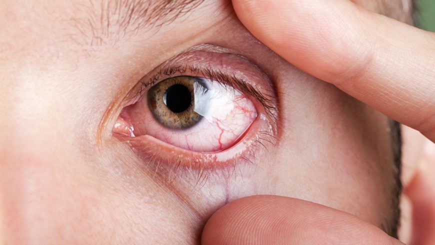 A importância dos exames periódicos para manter a saúde ocular