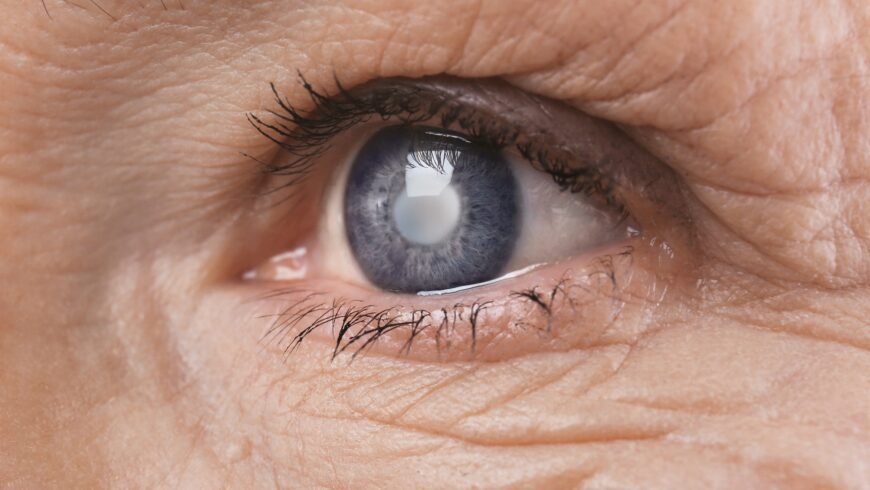 Como é feito o diagnóstico do Glaucoma?